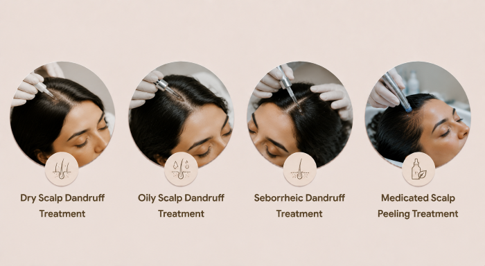Dandruff Scalp Treatment in Thane at Ameya Skin Clinic